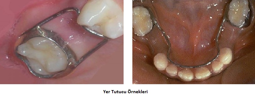 Çocuklarda Diş Bakımı: Yaşa Göre Rehber